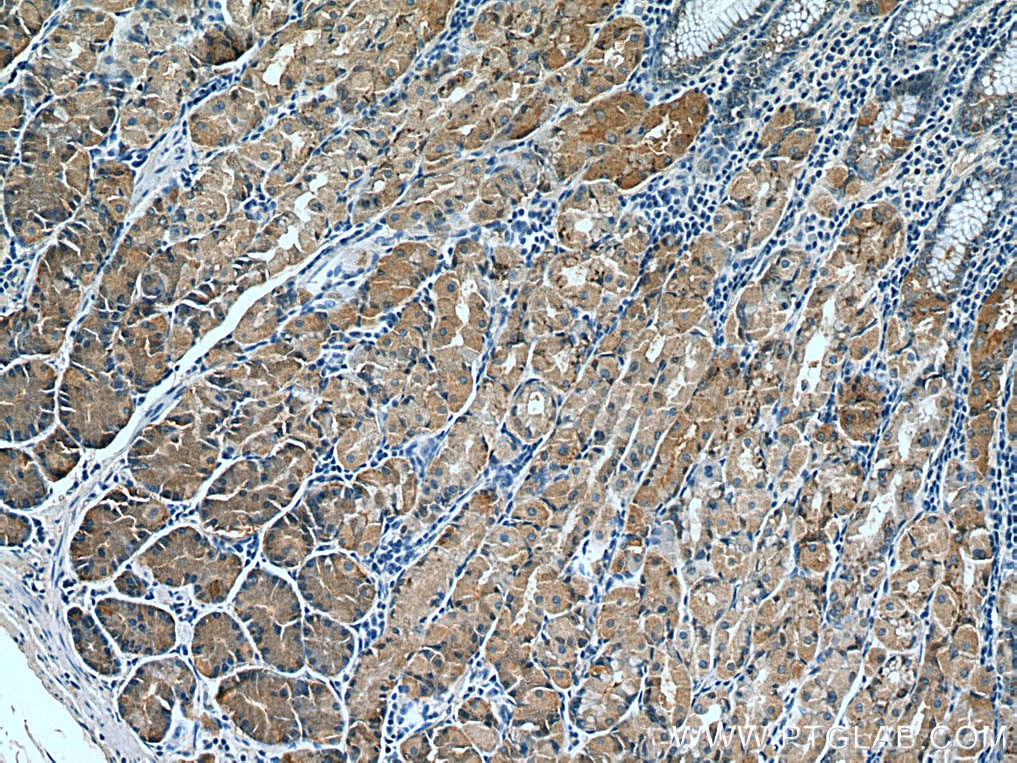 IHC staining of human stomach using 67484-1-Ig