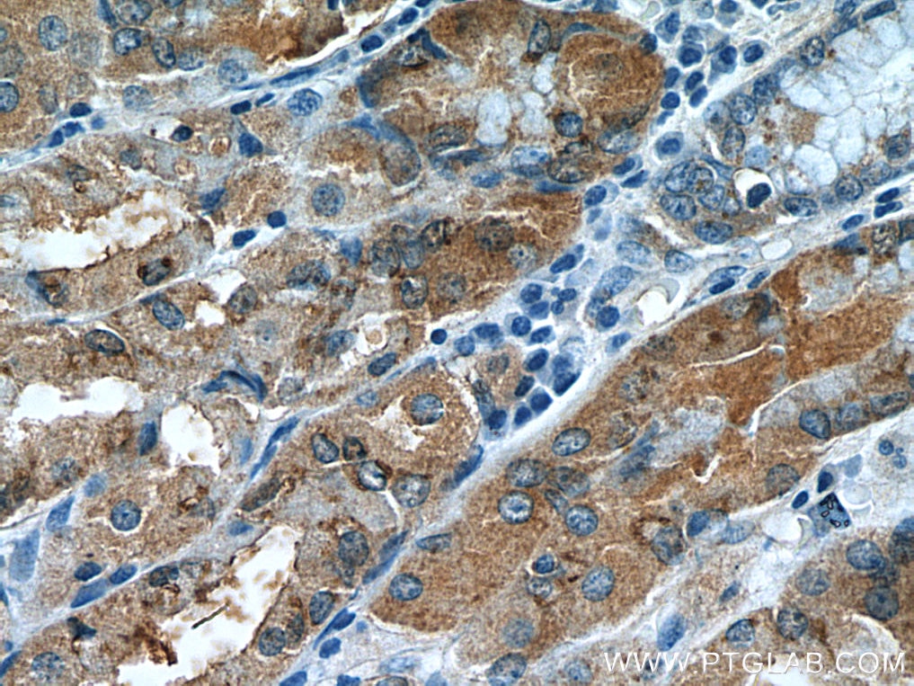 Immunohistochemistry (IHC) staining of human stomach tissue using AHCYL2 Monoclonal antibody (67484-1-Ig)