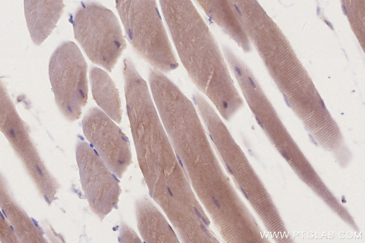 Immunohistochemistry (IHC) staining of mouse skeletal muscle tissue using AHCYL2 Monoclonal antibody (67484-1-Ig)