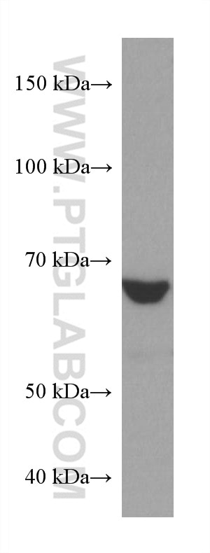 Western Blot (WB) analysis of LNCaP cells using AHCYL2 Monoclonal antibody (67484-1-Ig)