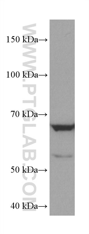 Western Blot (WB) analysis of HeLa cells using AHCYL2 Monoclonal antibody (67484-1-Ig)