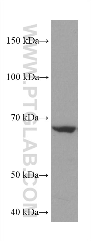 Western Blot (WB) analysis of A549 cells using AHCYL2 Monoclonal antibody (67484-1-Ig)