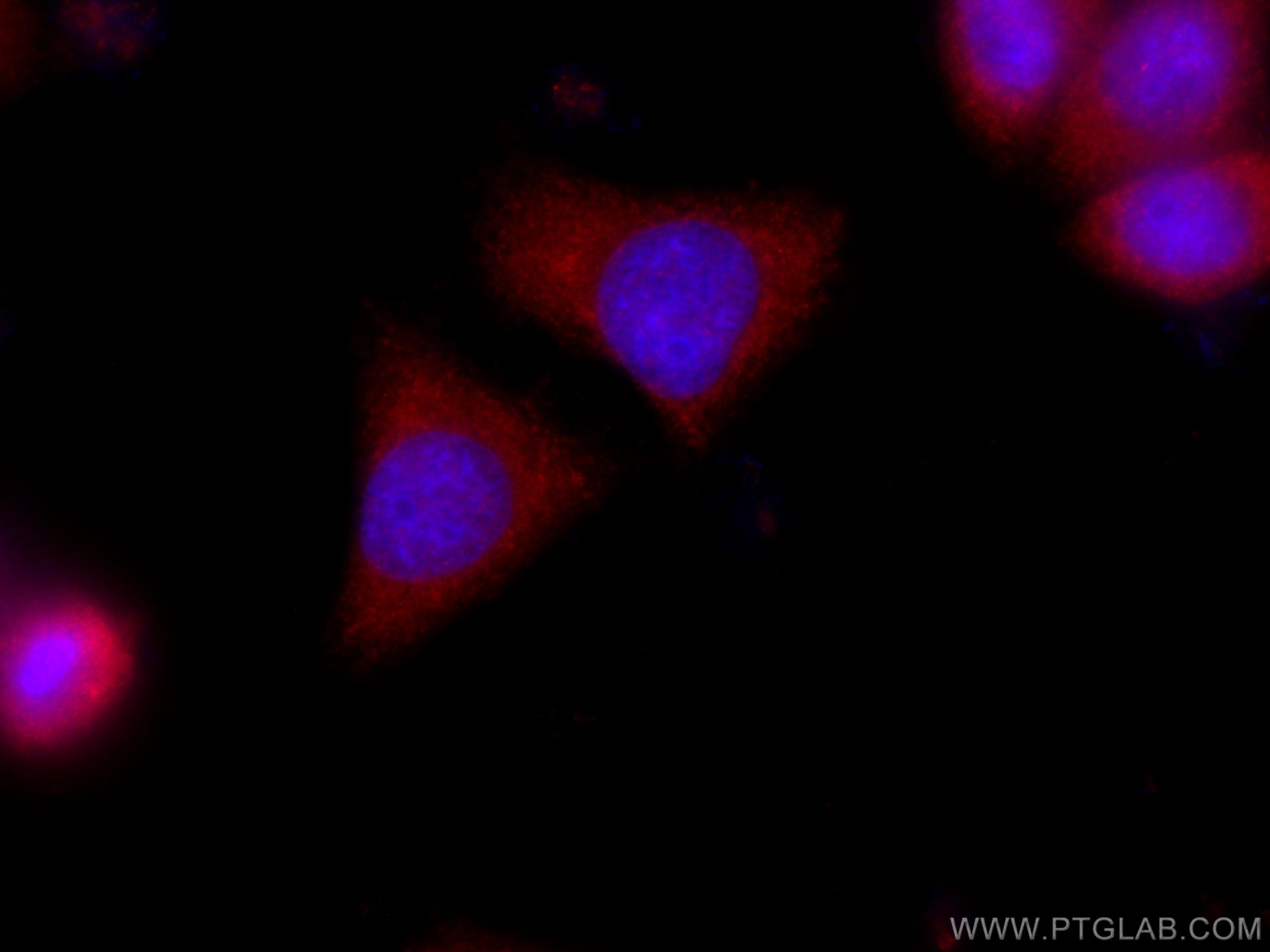 Immunofluorescence (IF) / fluorescent staining of PC-3 cells using CoraLite®594-conjugated AHCYL2 Monoclonal antibody (CL594-67484)