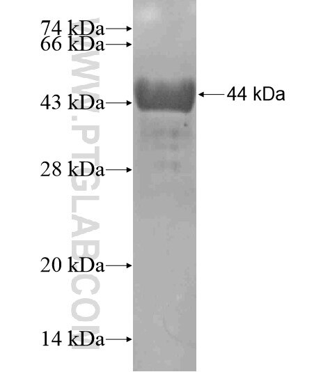 AHCYL2 fusion protein Ag19552 SDS-PAGE