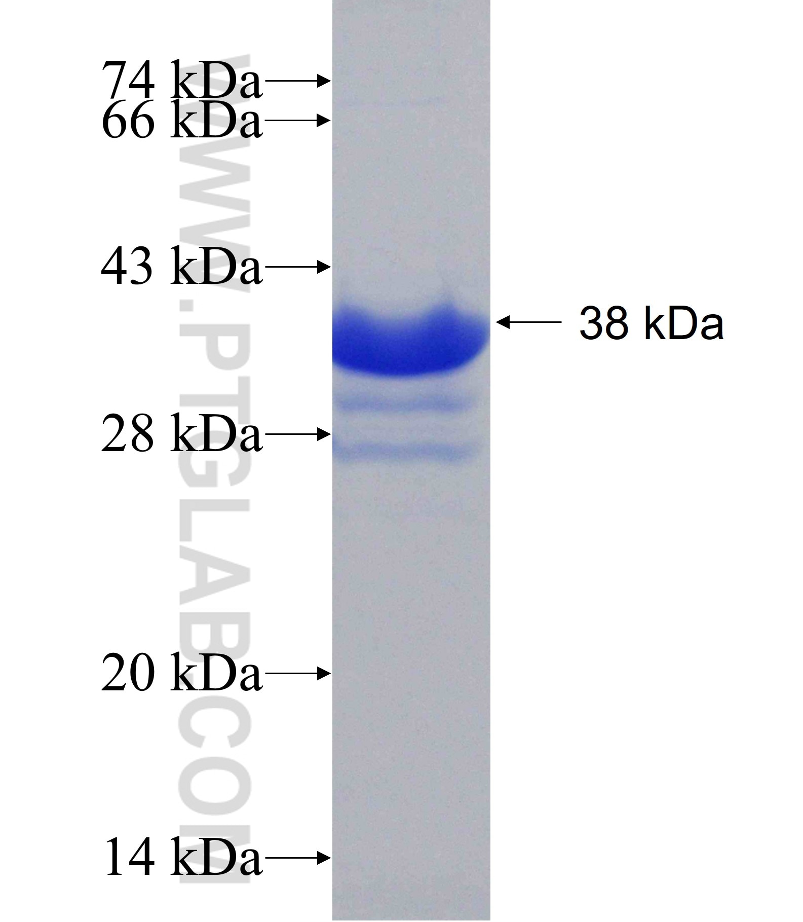 AHCYL2 fusion protein Ag19552 SDS-PAGE