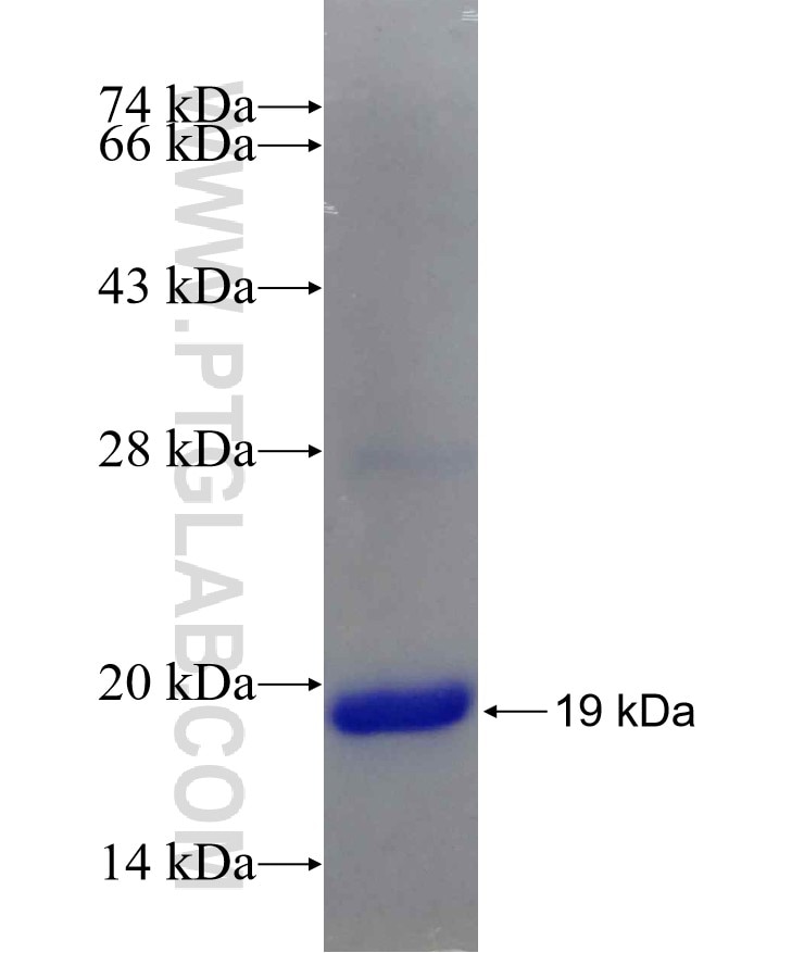 AHCYL2 fusion protein Ag19614 SDS-PAGE