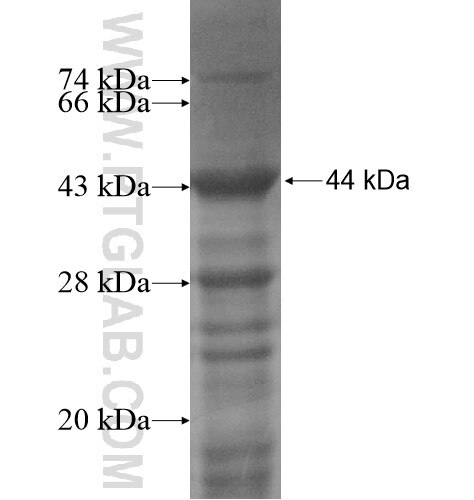 AHDC1 fusion protein Ag14121 SDS-PAGE