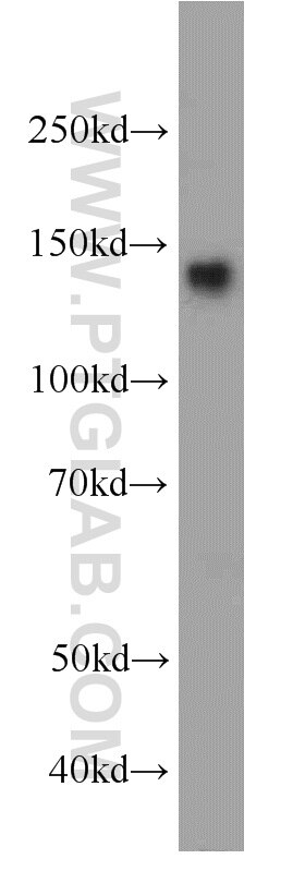 AHI1 Polyclonal antibody