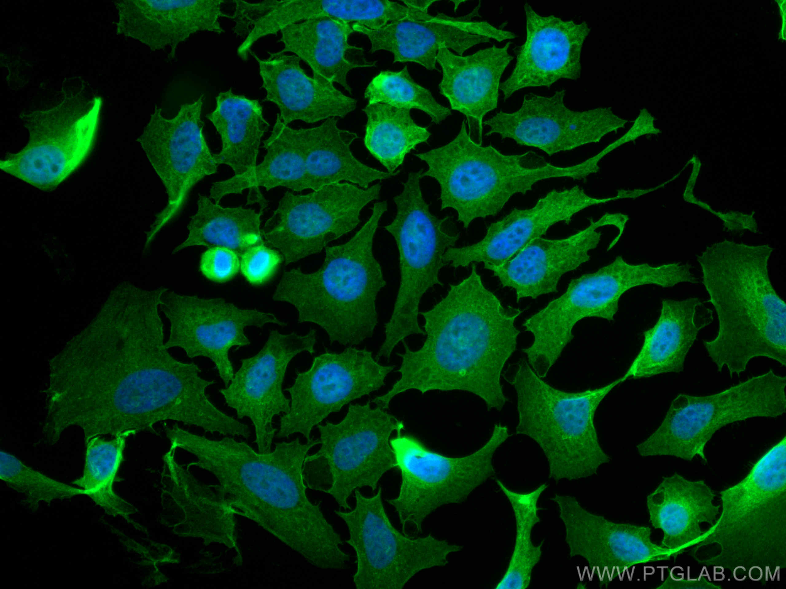 Immunofluorescence (IF) / fluorescent staining of HeLa cells using AHNAK Polyclonal antibody (16637-1-AP)