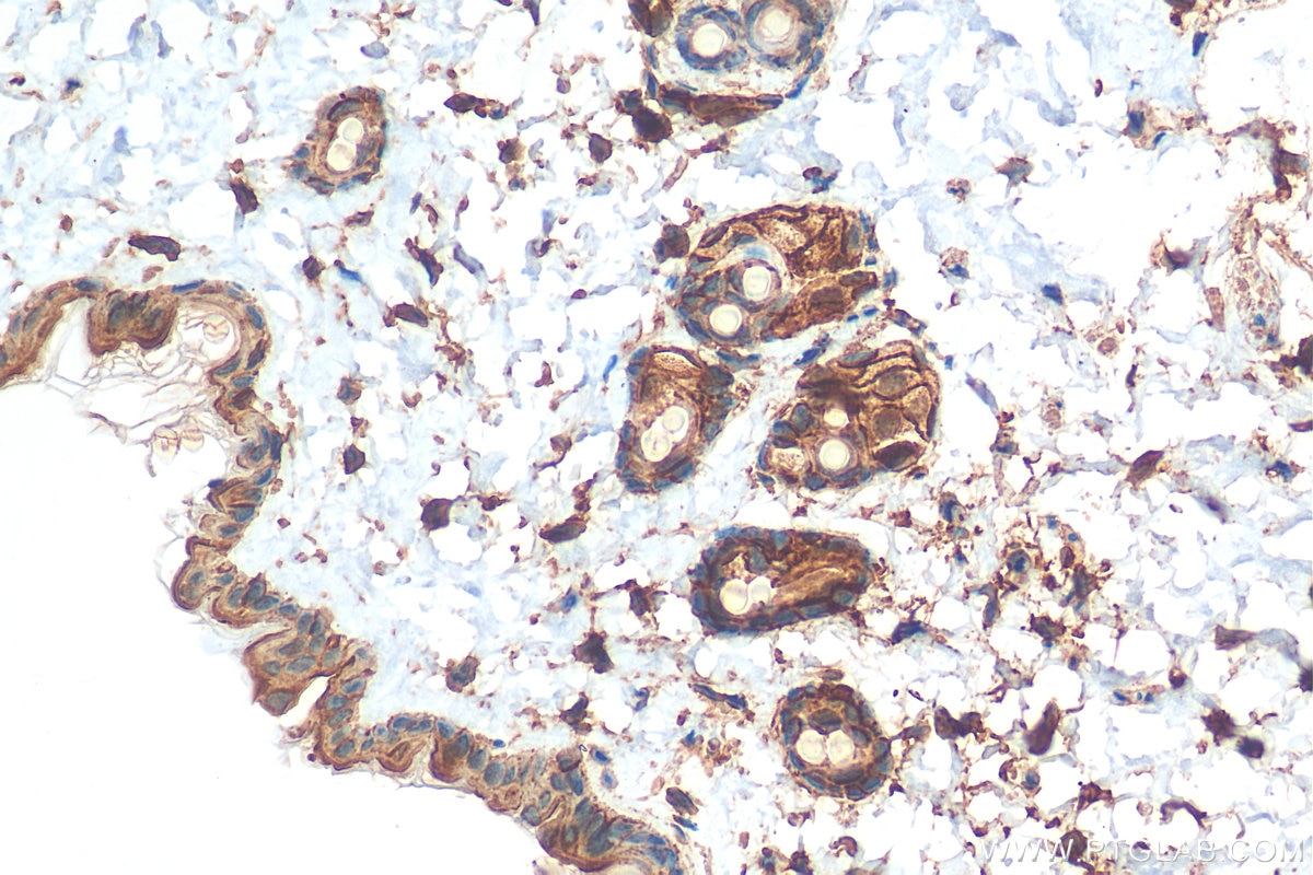 Immunohistochemistry (IHC) staining of mouse skin tissue using AHNAK Polyclonal antibody (16637-1-AP)