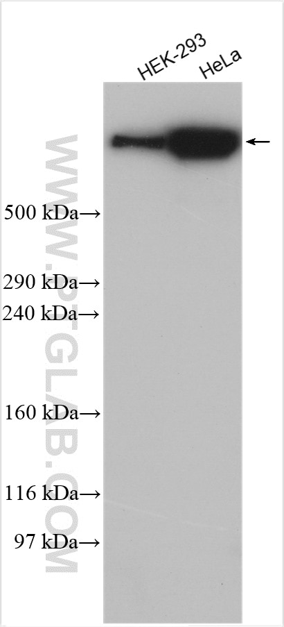 Western Blot (WB) analysis of various lysates using AHNAK Polyclonal antibody (16637-1-AP)