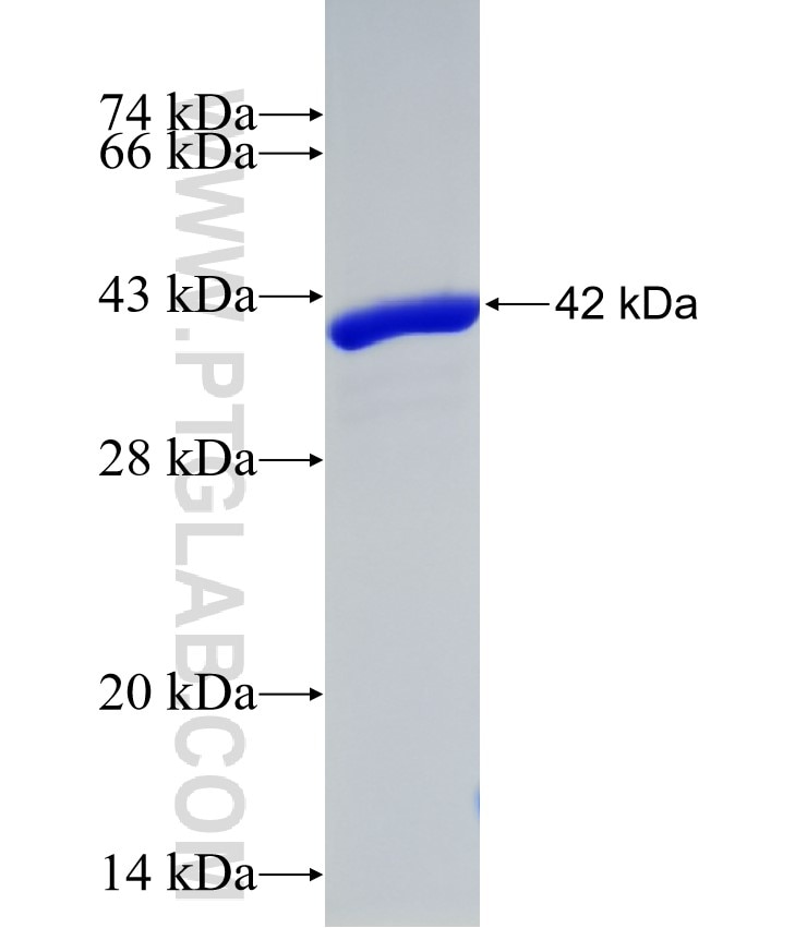 AHNAK fusion protein Ag3238 SDS-PAGE