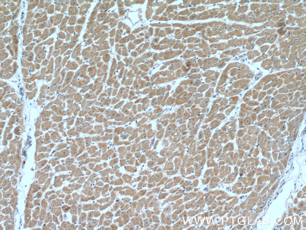 Immunohistochemistry (IHC) staining of human heart tissue using AHNAK2 Polyclonal antibody (27078-1-AP)