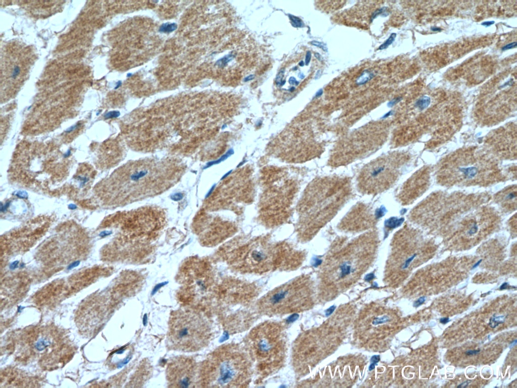 Immunohistochemistry (IHC) staining of human heart tissue using AHNAK2 Polyclonal antibody (27078-1-AP)