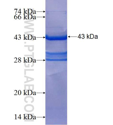 AHNAK2 fusion protein Ag25895 SDS-PAGE
