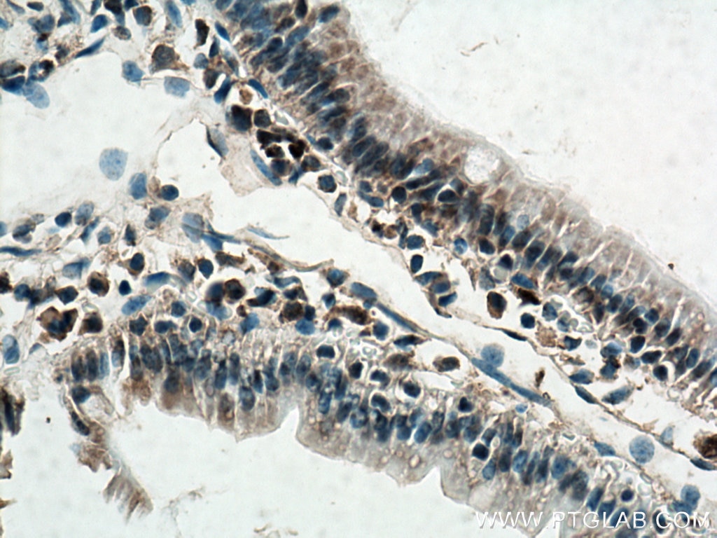 Immunohistochemistry (IHC) staining of mouse small intestine tissue using AHR Polyclonal antibody (17840-1-AP)