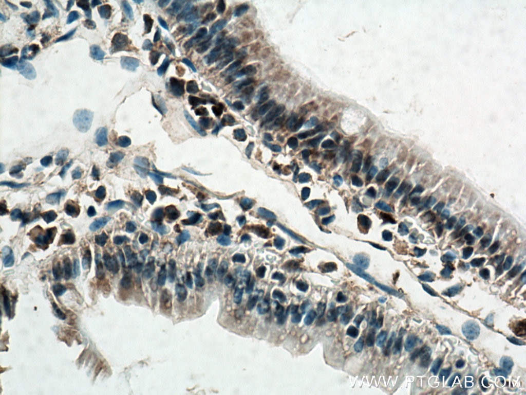 Immunohistochemistry (IHC) staining of mouse small intestine tissue using AHR Polyclonal antibody (17840-1-AP)