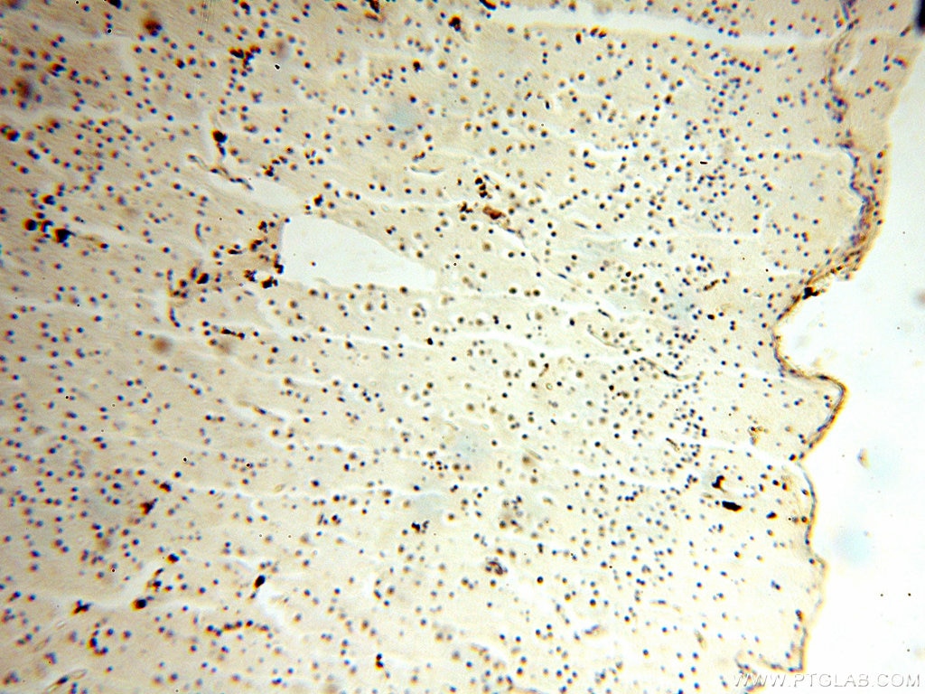 Immunohistochemistry (IHC) staining of human brain tissue using AHR Polyclonal antibody (17840-1-AP)