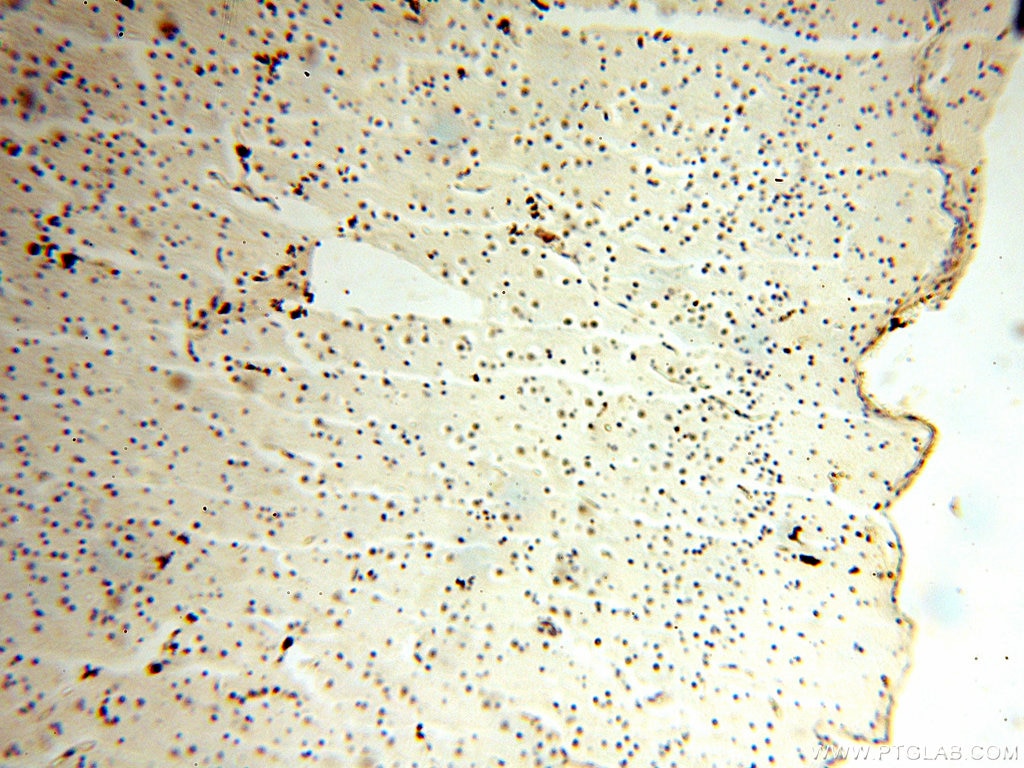 IHC staining of human brain using 17840-1-AP