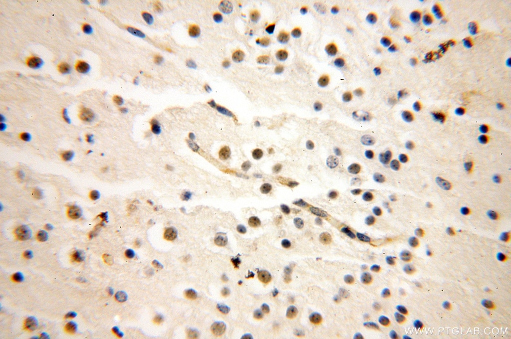 Immunohistochemistry (IHC) staining of human brain tissue using AHR Polyclonal antibody (17840-1-AP)