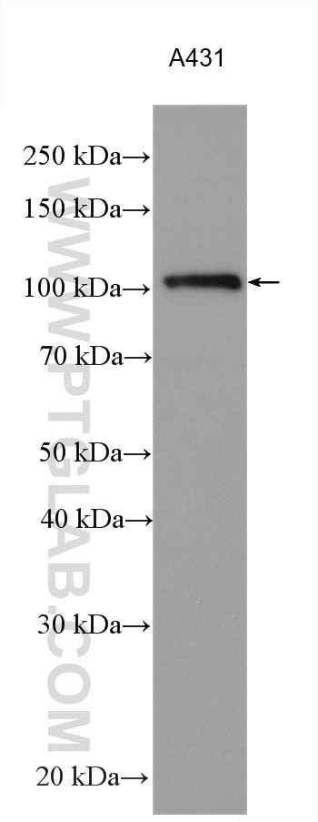 Western Blot (WB) analysis of various lysates using AHR Polyclonal antibody (28727-1-AP)