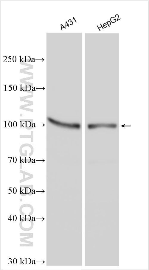 Western Blot (WB) analysis of various lysates using AHR Polyclonal antibody (28727-1-AP)