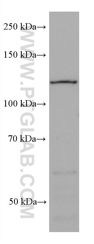 Western Blot (WB) analysis of MCF-7 cells using AHR Monoclonal antibody (67785-1-Ig)