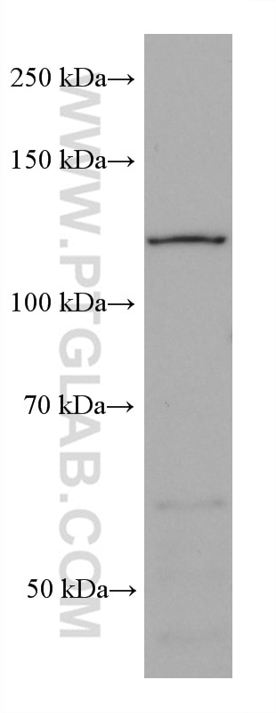 WB analysis of MCF-7 using 67785-1-Ig