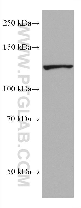 Western Blot (WB) analysis of 4T1 cells using AHR Monoclonal antibody (67785-1-Ig)