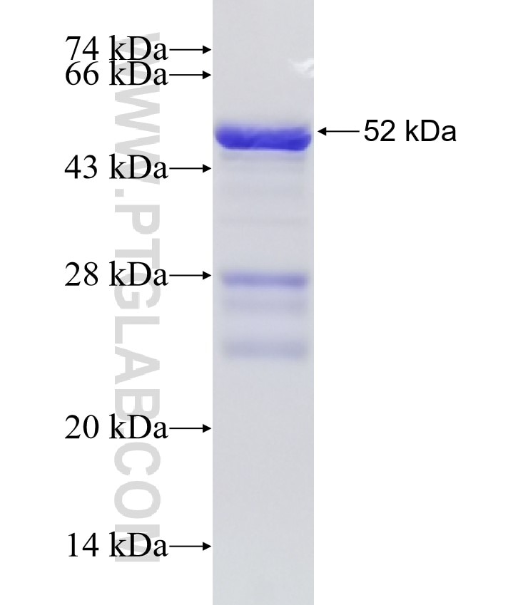 AHR fusion protein Ag32335 SDS-PAGE