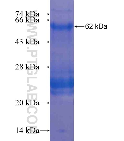 AHRR fusion protein Ag20256 SDS-PAGE