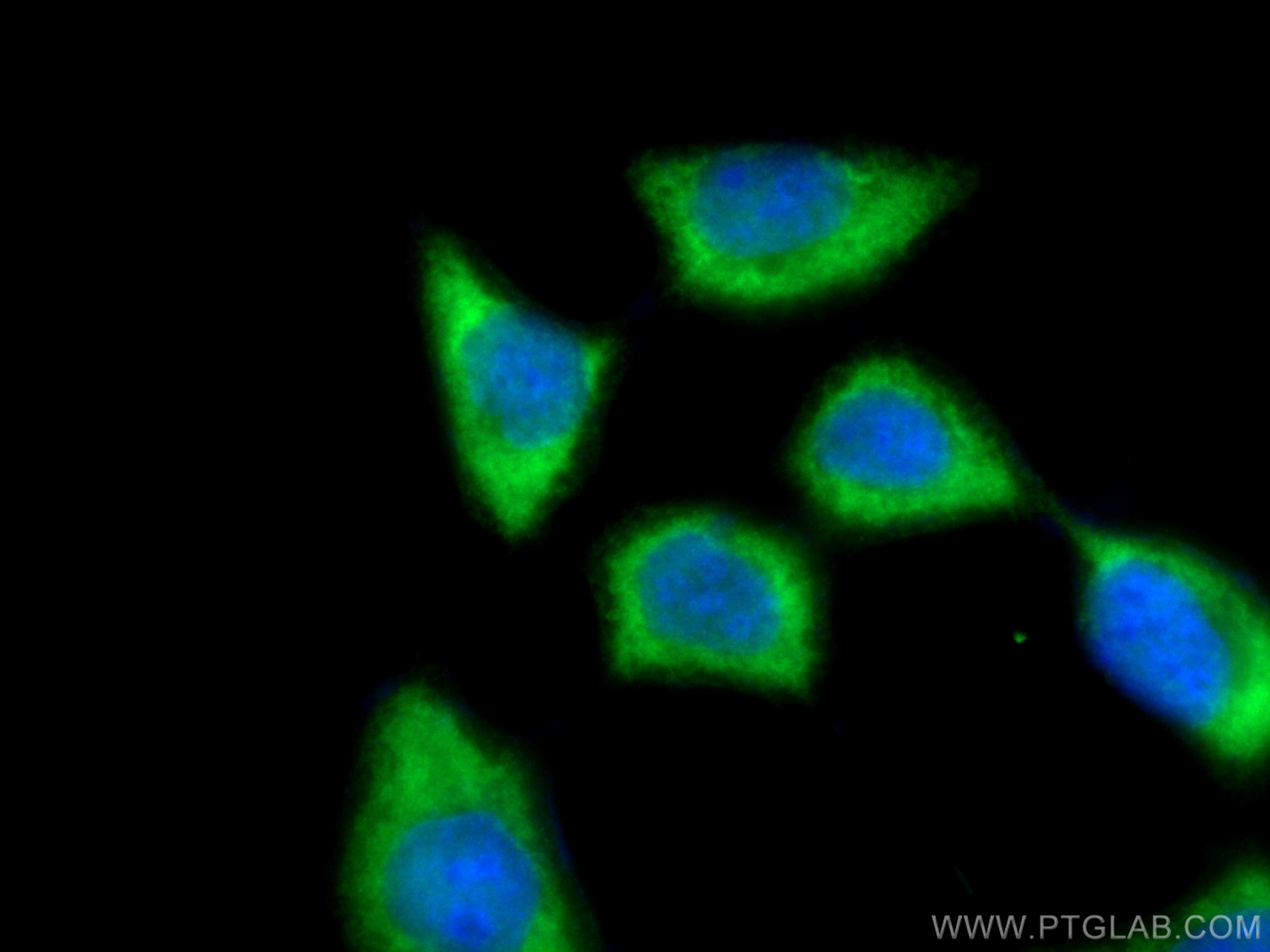 Immunofluorescence (IF) / fluorescent staining of A431 cells using AHSA1 Polyclonal antibody (14725-1-AP)