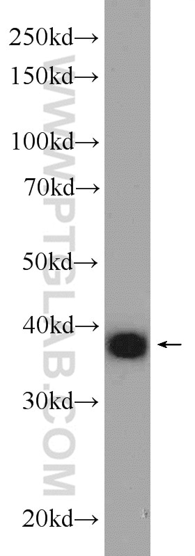 Western Blot (WB) analysis of A431 cells using AHSA1 Polyclonal antibody (14725-1-AP)