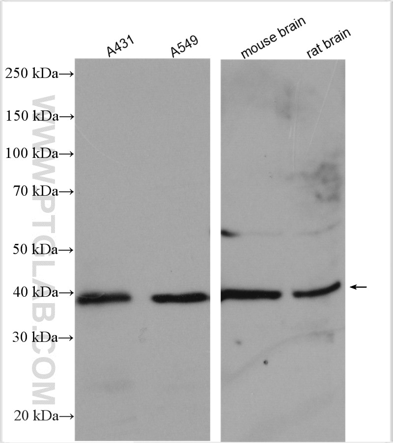 Western Blot (WB) analysis of various lysates using AHSA1 Polyclonal antibody (14725-1-AP)