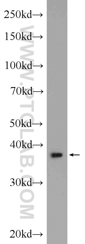 Western Blot (WB) analysis of HEK-293 cells using AHSA1 Polyclonal antibody (14725-1-AP)