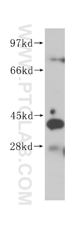 Western Blot (WB) analysis of HeLa cells using AHSA1 Polyclonal antibody (14725-1-AP)