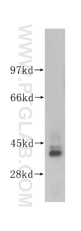 Western Blot (WB) analysis of mouse brain tissue using AHSA1 Polyclonal antibody (14725-1-AP)