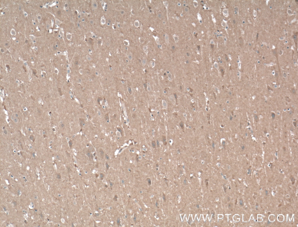 Immunohistochemistry (IHC) staining of human brain tissue using AHSA2 Polyclonal antibody (55447-1-AP)