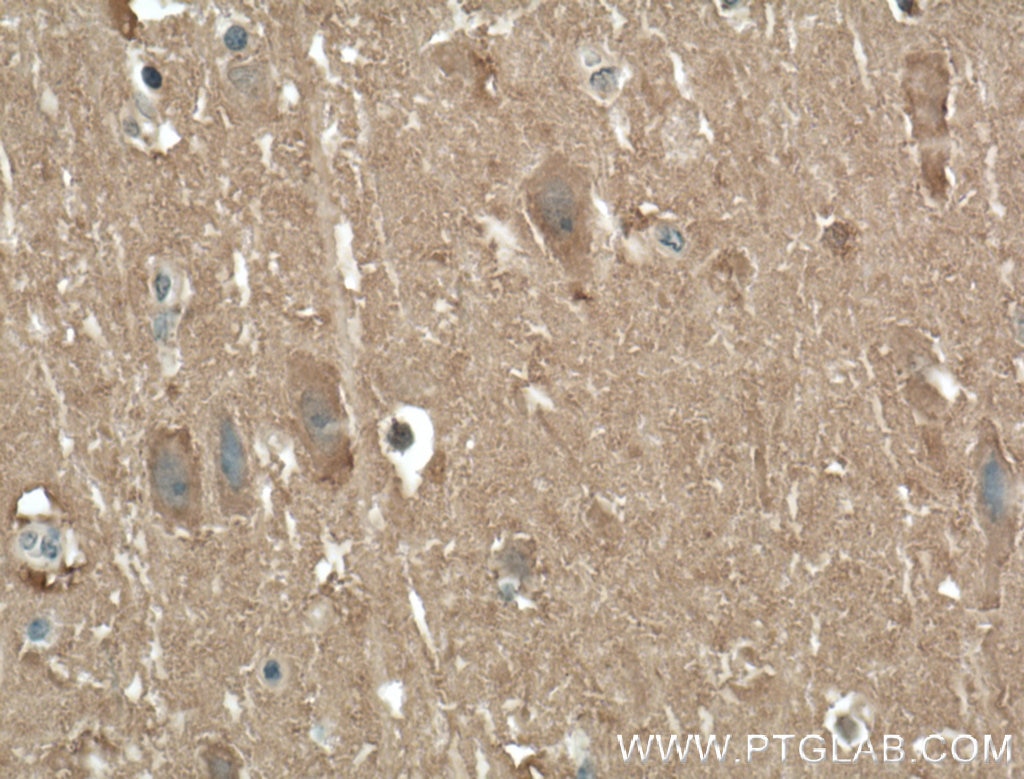 Immunohistochemistry (IHC) staining of human brain tissue using AHSA2 Polyclonal antibody (55447-1-AP)