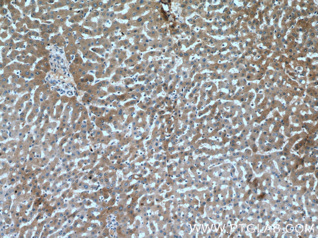 Immunohistochemistry (IHC) staining of human liver tissue using Fetuin-A Polyclonal antibody (16571-1-AP)