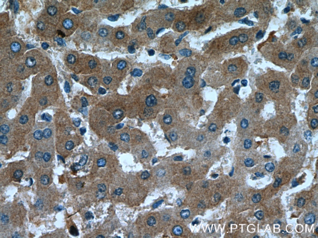 Immunohistochemistry (IHC) staining of human liver tissue using Fetuin-A Polyclonal antibody (16571-1-AP)