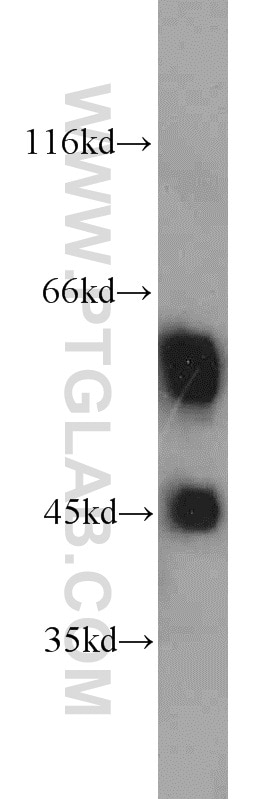 Western Blot (WB) analysis of human heart tissue using Fetuin-A Polyclonal antibody (16571-1-AP)