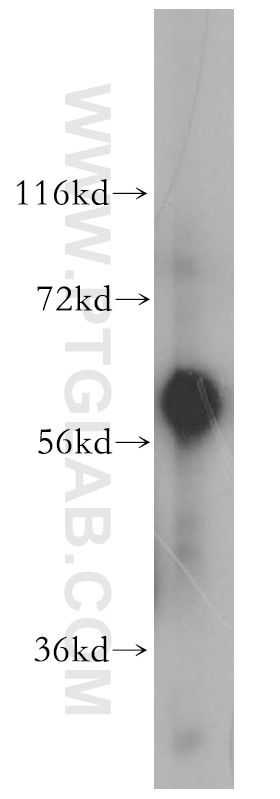 Western Blot (WB) analysis of human liver tissue using Fetuin-A Polyclonal antibody (16571-1-AP)