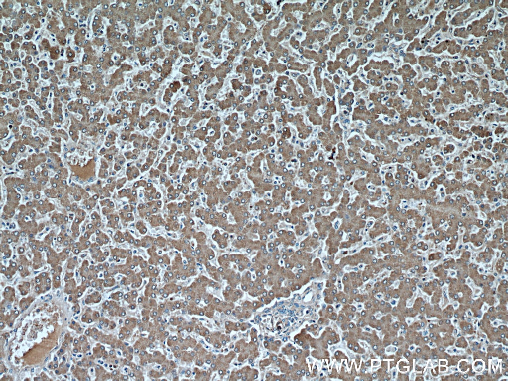 Immunohistochemistry (IHC) staining of human liver tissue using Fetuin-A Monoclonal antibody (66094-1-Ig)