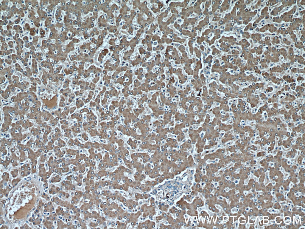 IHC staining of human liver using 66094-1-Ig