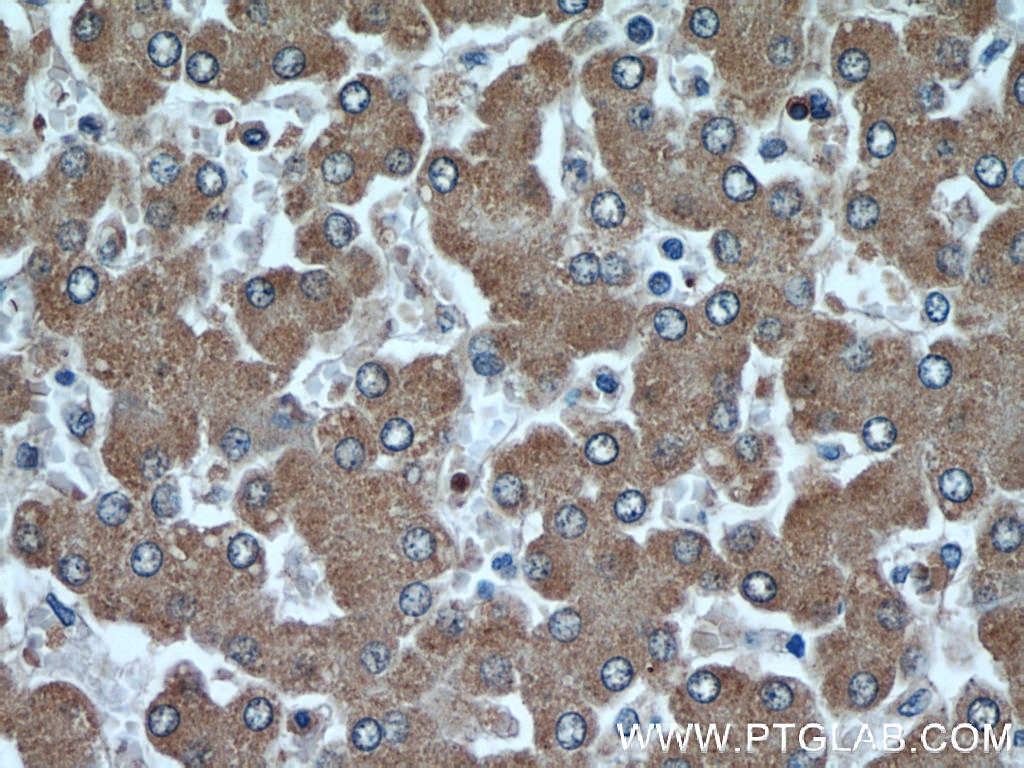 Immunohistochemistry (IHC) staining of human liver tissue using Fetuin-A Monoclonal antibody (66094-1-Ig)