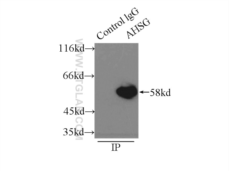 Immunoprecipitation (IP) experiment of HepG2 cells using Fetuin-A Monoclonal antibody (66094-1-Ig)