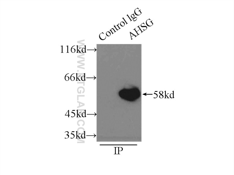 IP experiment of HepG2 using 66094-1-Ig