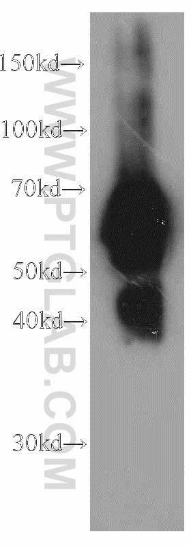 Western Blot (WB) analysis of human plasma using Fetuin-A Monoclonal antibody (66094-1-Ig)