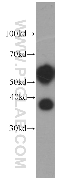 Western Blot (WB) analysis of human heart tissue using Fetuin-A Monoclonal antibody (66094-1-Ig)